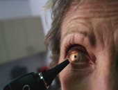 تطور جديد فى الطب.. كيف أصبحت العين وسيلة الكشف عن ألزهايمر