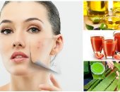 وصفات طبيعية انسيها لو بشرتك دهنية.. زيت الزيتون والطماطم فى المقدمة
