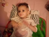 صور ..الطفلة "أمنية" بالشرقية تعانى من ورم بالمخ وتحتاج سرير بمستشفى57   