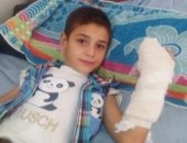 مستشفى عام بالزقازيق ينجح في إعادة توصيل إصبع مبتور لطفل بعد رفض 7مستشفيات
