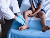 مدير مركز الأعصاب بـ"طب عين شمس": رصدنا وفاة 73 طفلًا مريضًا بضمور العضلات خلال عامين