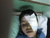  "أحمد" ذو 7 سنوات يفقد إحدى عينيه فى أول يوم دراسى بالشرقية
