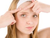 صحتك فى وصفة..استخدم الثوم والليمون لعلاج حب الشباب