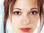 وصفات طبيعية من خل التفاح لعلاج البقع الداكنة والعناية بالبشرة