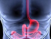 إيه هو عسر الهضم.. وامتى تكون زيارة الطبيب ضرورة