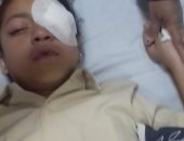 إصابة تلميذة فى العين أثناء لهوها داخل مدرسة نجع حسان الإبتدائية بالأقصر