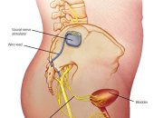 التهاب المسالك البولية أعراضه وعلاماته وعلاجه