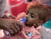 فيس بوك يزيل آلاف المشاركات لمقالة تناولت معاناة أطفال اليمن