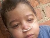 استغاثة أم: طفلى مصاب بتليف فى الرئتين ويحتاج لجراحة فى مستشفى أبو الريش