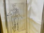 شاهد.. أول كتاب مطبوع عن الطب فى العالم الإسلامى عمره 198 عاما