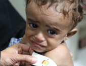 "سوء التغذية وتأثيره على الصحة" فى فعاليات الأسبوع العربى للتنمية
