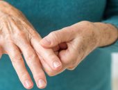  علاج جديد لإلتهاب المفاصل يمنع تلف الغضاريف