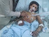 بعد ذبحه لسرقته..إنقاذ شاب من الموت بخياطة قصبته الهوائية بمستشفى بنها الجامعى