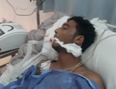 صور.. "خطأ طبى يدمر حياة أسرة" محمد دخل غرفة العمليات وخرج بضمور فى المخ