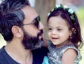 حارب التنمر بموهبتك.. جلسة تصوير  لإبراز جمال البشرة السمراء وأطفال متلازمة دوان