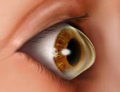 مشاكل صحية تصيب العين وتحتاج لزرع القرنية.. تعرف عليها