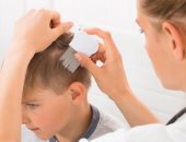 اسباب تساقط الشعر عند الأطفال وطرق العلاج