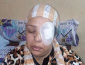 ممرضة تتهم مترددا بمستشفى تأمين أسوان بفقأ عينها