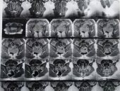 قارئة تستغيث بسرعة علاجها من ورم فى الحوض