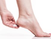 علاج مسمار القدم بتغيير الأحذية والعملية الجراحية