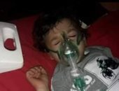 استجابة لـ"اليوم السابع".. "الصحة" تتكفل بعلاج الطفل محمود بعد نشر معاناته