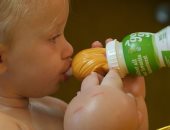 صور.. طفلة عامين تصاب بمرض نادر يجعل يديها عملاقة