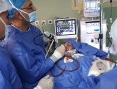 صور.. استئصال ورم دموى بجمجمة طفل بمستشفى التأمين الصحى ببنها