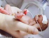 "أد كف الأيد".. طفل يولد قبل الأوان يزن 490 جراما فى الصين.. صور