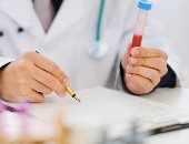  تعرف على تحاليل طبية يجب عليك الصيام قبل إجرائها 