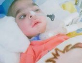 يوسف 11 شهر آخر ضحايا "الضمور الشوكى".. ووالدته تناشد بعلاجه فى الخارج