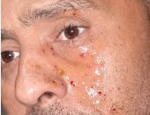 شاهد..محمود عبد المغنى يتعرض لإصابة فى وجهه أثناء تصوير "حملة فرعون"