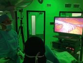 إجراء 30 عملية جراحية مجانية لعلاج السمنة المفرطة بجامعة أسيوط