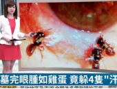 تغذوا على دموعها.. أطباء يستخرجون 4 نحلات "حية" من عين شابة تايوانية 
