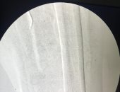 لأول مرة.. استخدام تقنية ثانى أكسيد الكربون فى عمليات انسداد الشرايين بمستشفيات أسيوط الجامعى