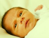 علاج الصفراء عند الاطفال حديثى الولادة بطرق عدة منها الآشعة الضوئية
