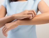 نصائح من أطباء الأمراض الجلدية لإدارة البشرة الحساسة