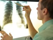 دراسة: الأشعة السينية على الصدر تتوقع شدة فيروس كورونا عند البالغين والشباب