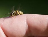 لو لدغتك نحلة.. طرق منزلية بسيطة للقضاء على الألم والحكة