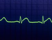 باحثون يطورون مكبرات صوت قادرة على مراقبة نبضات القلب