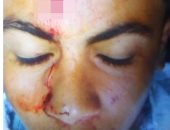 عاطل يعتدى على طالب ثانوى ويصيبه بـ"عاهة مستديمة" بدمياط