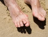 5 أشياء تسبب اصابتك بتشوه أصابع القدم.. منها الحذاء