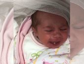 فيديو.. حالة نادرة لرضيعة سعودية وُلدت بـ"سن أمامية"