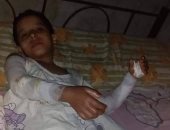 صور.. 6 أطفال مصابين بحروق فى انفجار أنبوبة بالقليوبية يناشدون بمساعدتهم