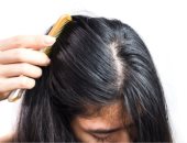 الألوفيرا لعلاج الشعر وفروة الرأس الدهنية في الصيف