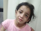 نقابة المحامين بدمياط تعلن تضامها مع طفلة تعرضت للتعذيب على يد زوجة والدها