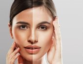 لو لسه راجعة من الساحل.. وصفات طبيعية لتفتيح البشرة