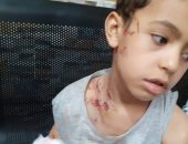 فيديو وصور ..هجوم للكلاب الشرسة على الأطفال بمدينة العبور