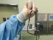 الأطباء يستخرجون 64 خرزة مغناطيسية من معدة طفل صينى.. صور  