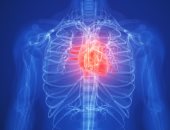 كيف يمكن أن تساعد الأشعة السينية فى التنبؤ بخطر الإصابة بنوبة قلبية؟
