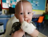 صور.. طفل 9 أشهر يقاتل نوعا نادرا من سرطان الخصية بعد اعتقاد الأطباء أنه فتق